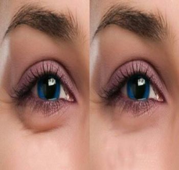 فواید آب سرد برای پوست