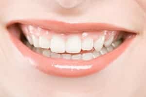 راه حل فوری برای سفید کردن دندان